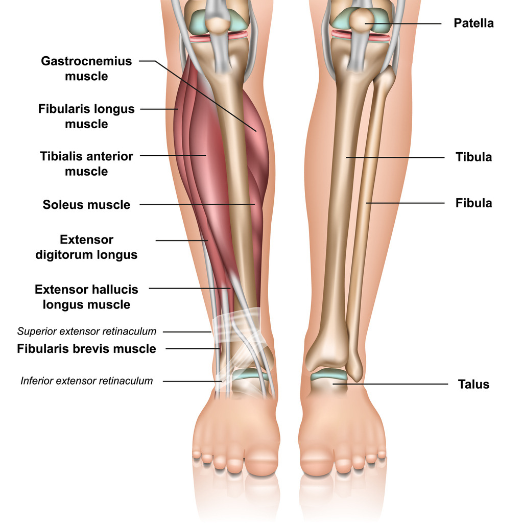 Shin Splints Paragon Orthotic Laboratory
