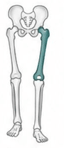 short femur