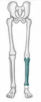 Short tibia